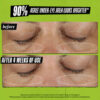 Kiehl's Creamy Eye Treatment with Avocado - Thumbnail Image 5