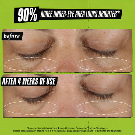 Kiehl's Creamy Eye Treatment with Avocado - Image 5